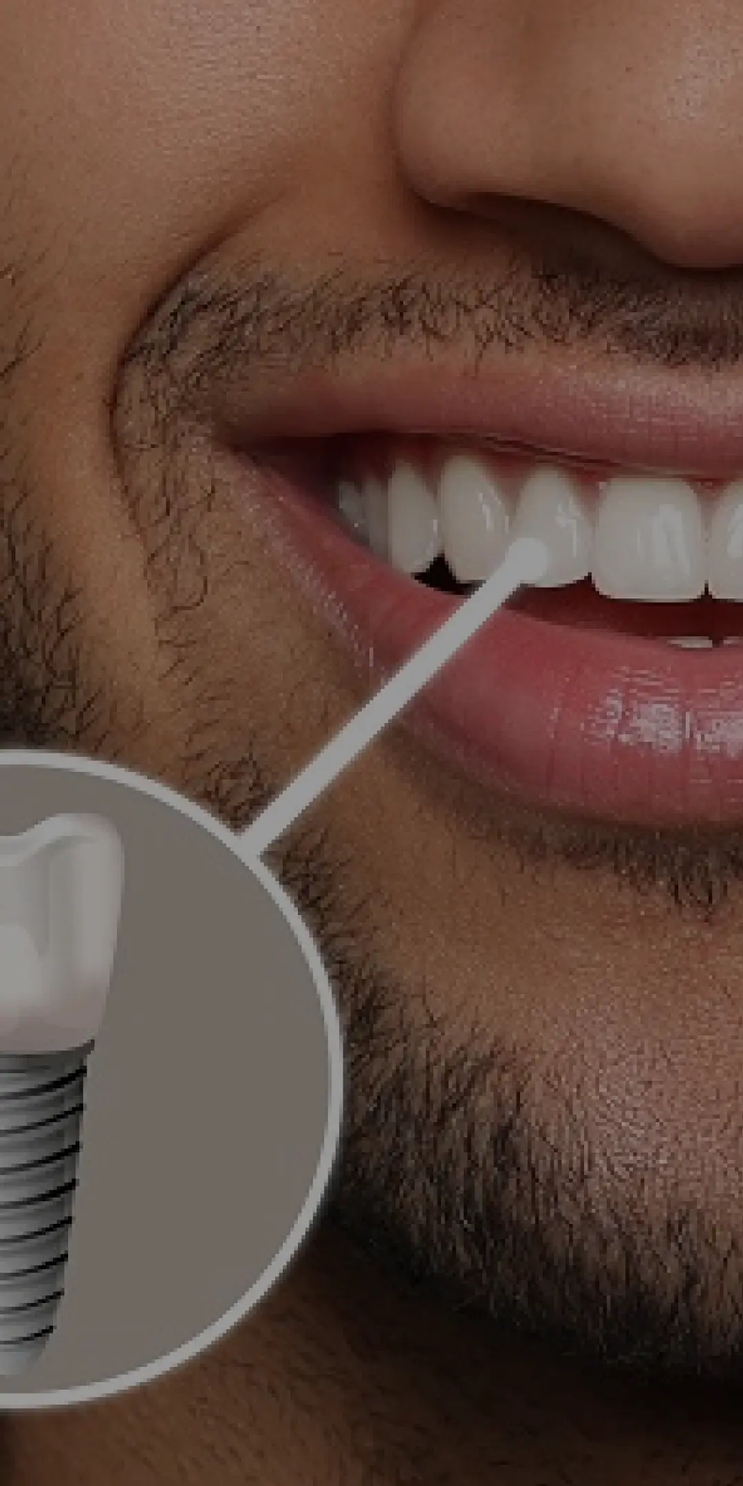 Mobile dental hero background