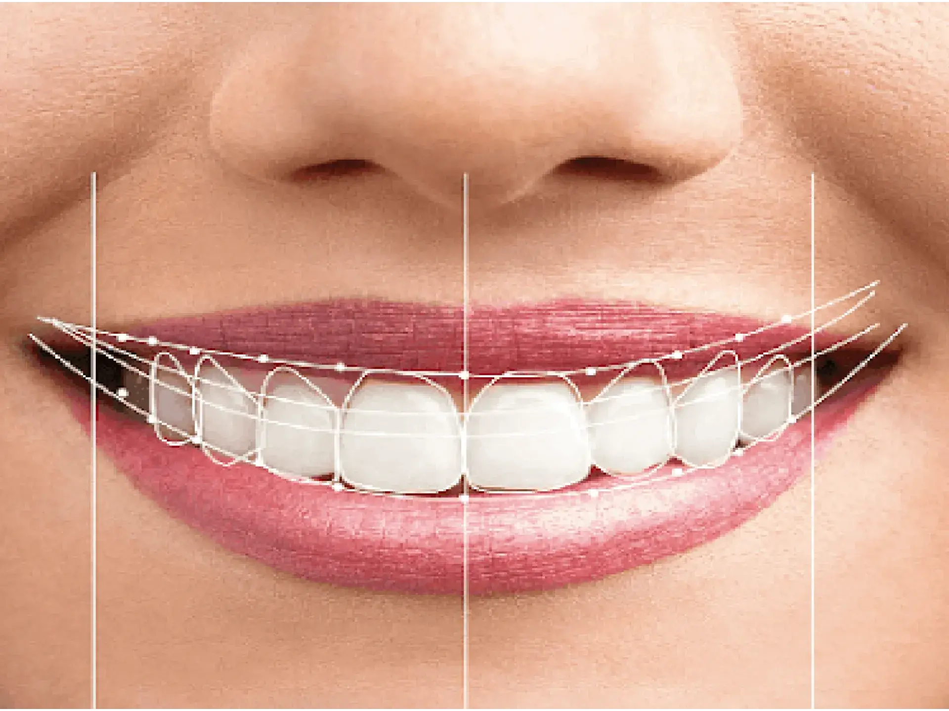 Dental Implants Hero Banner