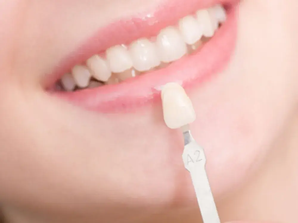 Dental Implants Hero Banner