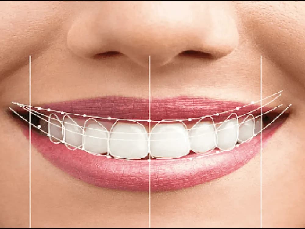 Dental Implants Hero Banner