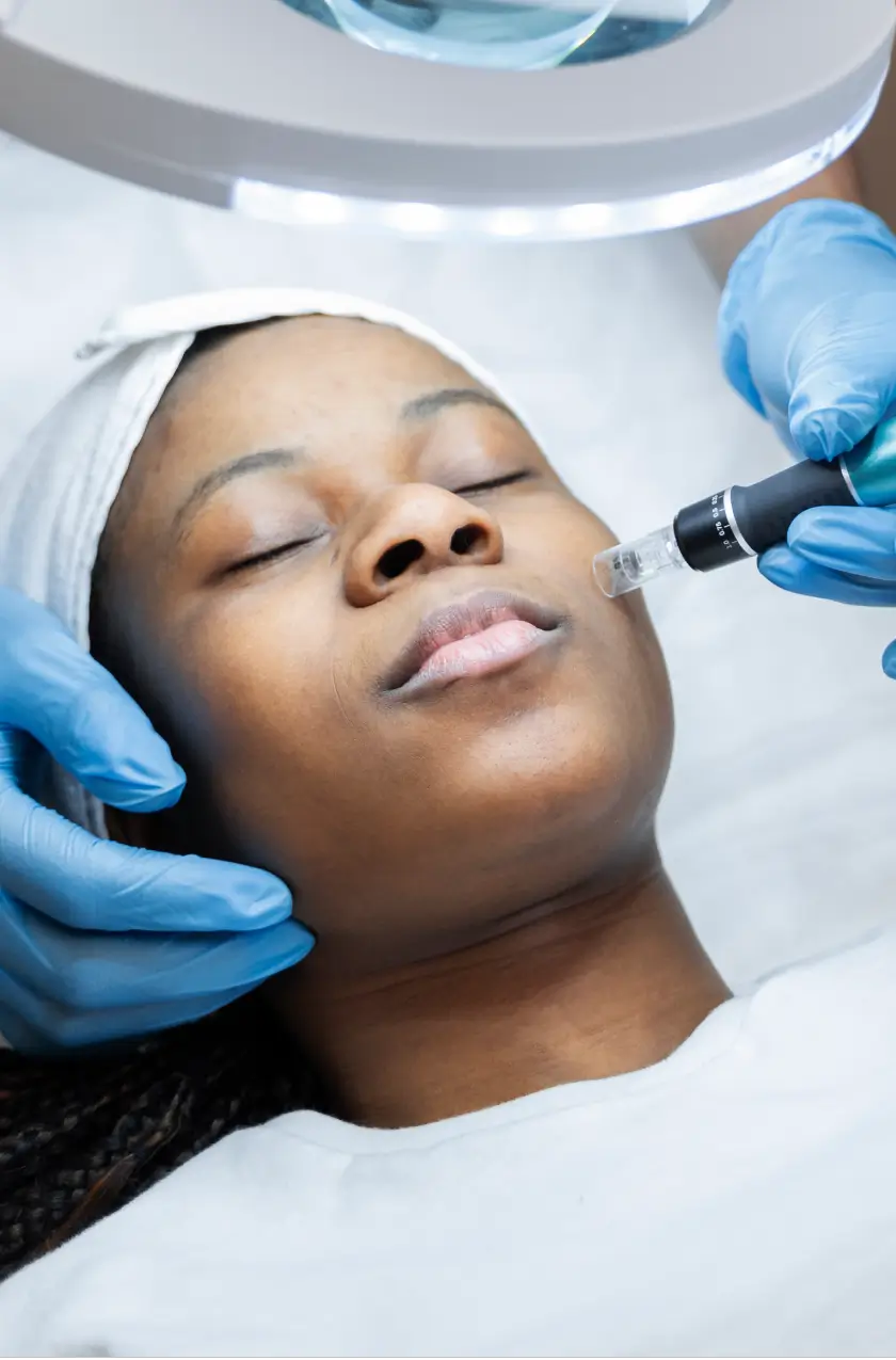 cryofacelift