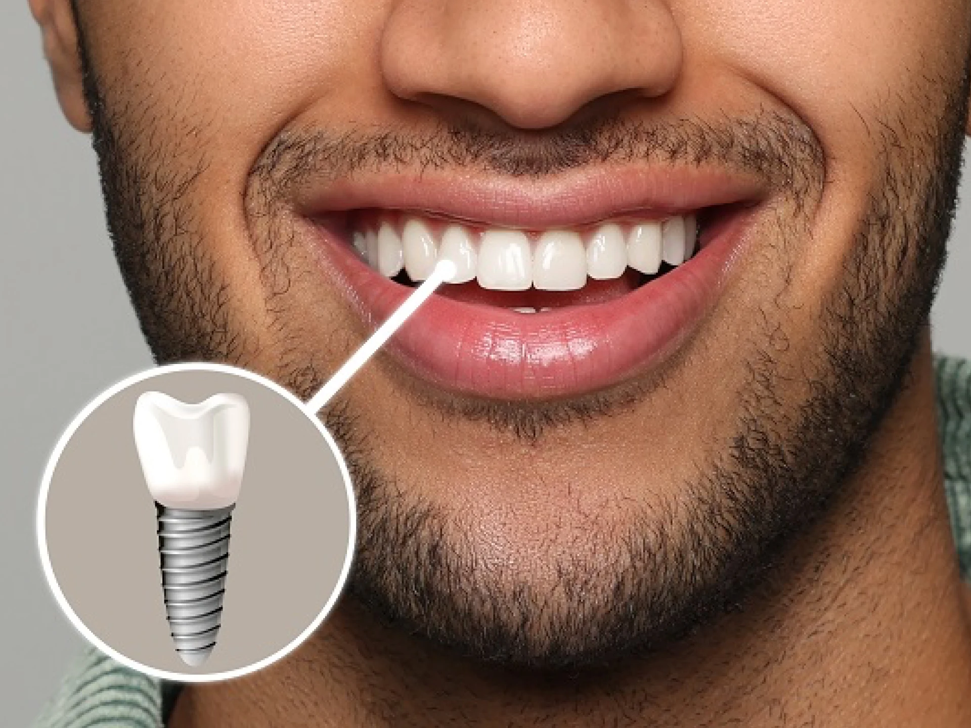dental implants desktop
